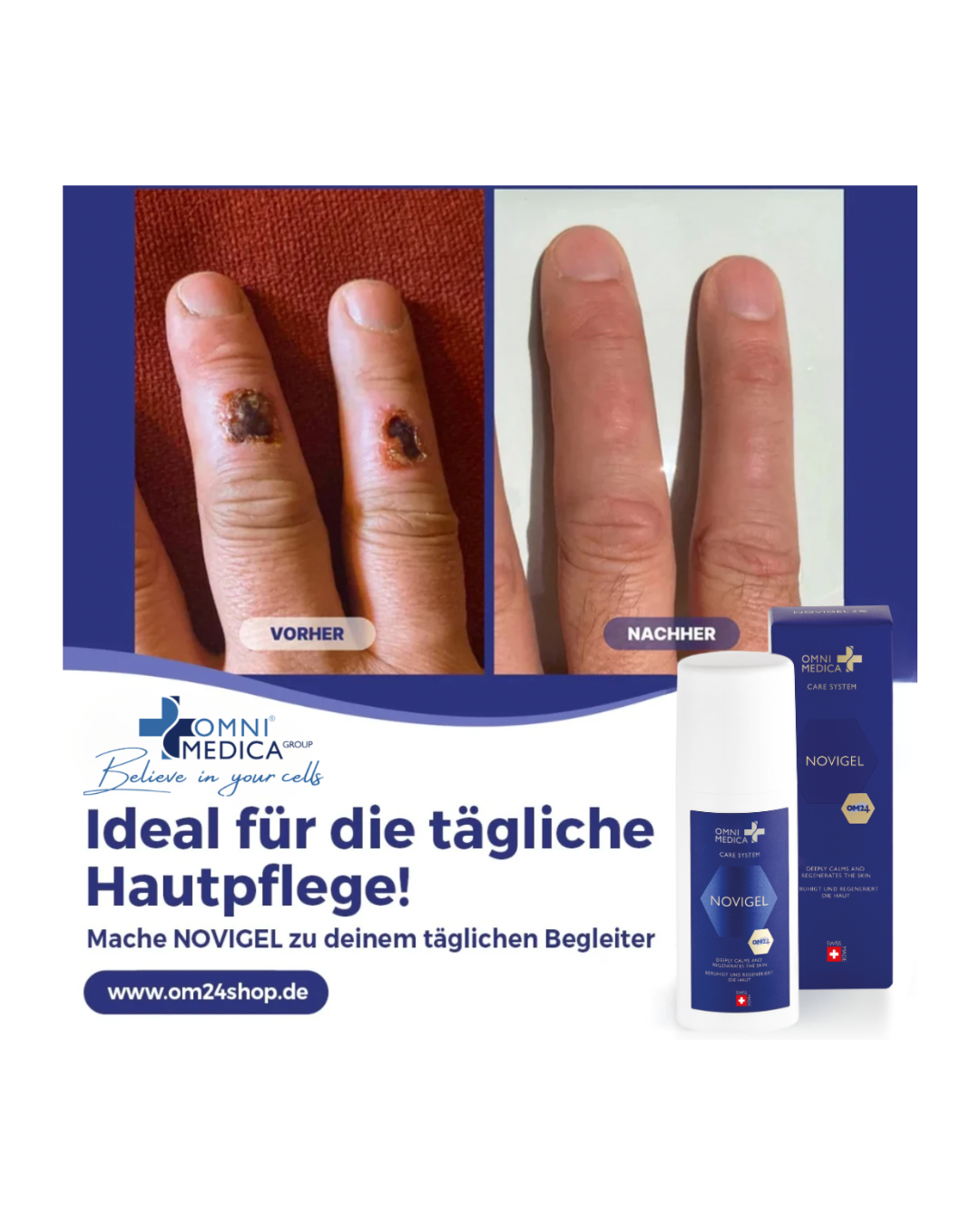 NOVIGEL - Hautregenerations- und Zellschutzserum (Copy)