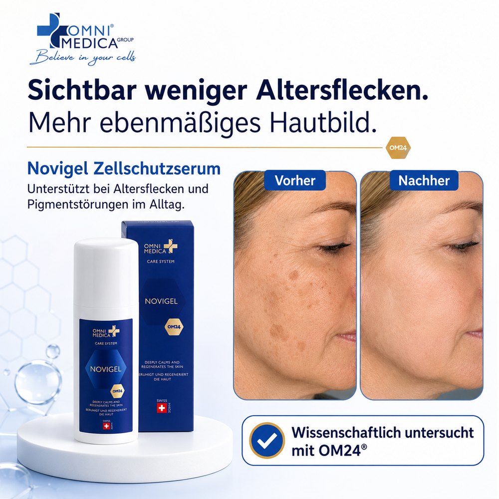 Novigel – sichtbar weniger Altersflecken